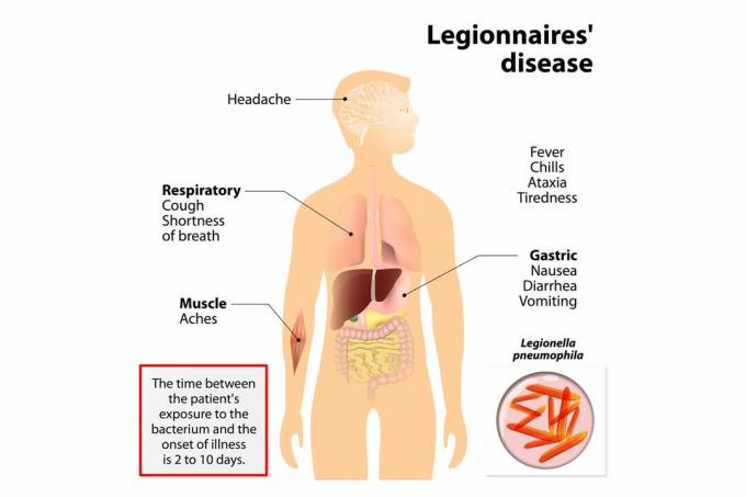 Таблица симптомов болезни легионеров